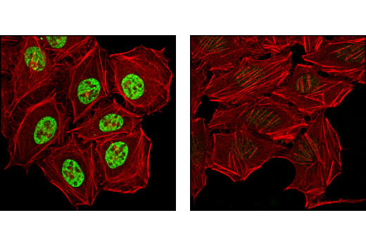 Confocal immunofluorescent analysis of HeLa cells, dexamethasone-treated (left) or lambda phosphatase-treated (right) using Phospho-Glucocorticoid Receptor (Ser211) Antibody (green). Actin filaments have been labeled with DY-554 phalloidin (red).