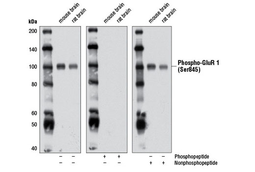 Western blot analysis of extracts from mouse brain and rat brain using Phospho-AMPA Receptor (GluR 1) (Ser845) (D10G5) Rabbit mAb. The phospho-specificity of the antibody was verified by blocking with a phospho or nonphosphopeptide.