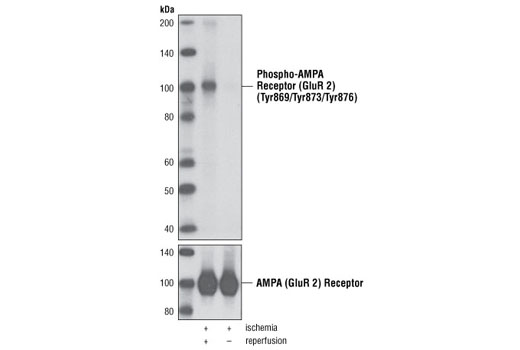 Western blot analysis of extracts from rat brain, either 15 min ischemia followed by 4 h reperfusion or 15 min ischemia only, using Phospho-AMPA Receptor (GluR 2) (Ty869/Tyr873/Tyr876) Antibody (upper) or AMPA Receptor (GluR 2/3/4) Antibody #2460 (lower).