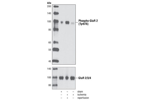 Western blot analysis of extracts from rat brain, either sham-operated, 15 min ischemia followed by 4 h reperfusion or 15 min ischemia only, using Phospho-AMPA Receptor (GluR 2) (Tyr876) Antibody (upper) or AMPA Receptor (GluR 2/3/4) Antibody #2460 (lower).