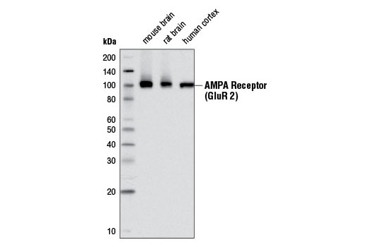 Western blot analysis of extracts from mouse brain, rat brain, and human cortex tissues using AMPA Receptor (GluR 2) (E1L8U) Rabbit mAb.
