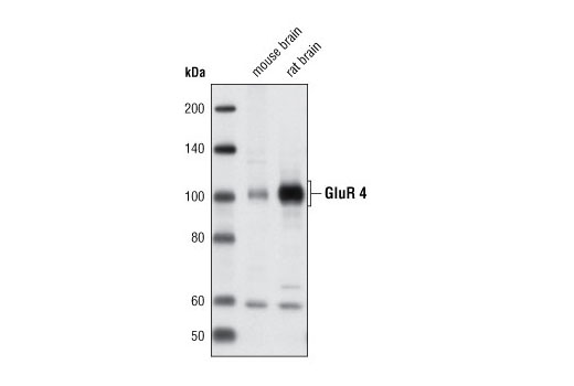 Western blot analysis of extracts from mouse and rat brain using AMPA Receptor (GluR 4) (Arg860) Antibody.