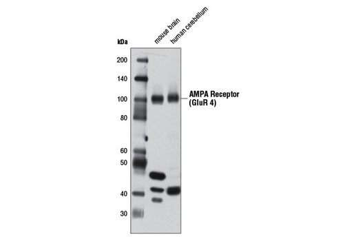 Western blot analysis of extracts from mouse brain and human cerebellum using AMPA Receptor (GluR 4) (D19G9) Rabbit mAb.