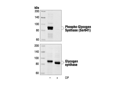 Western blot analysis of extracts from NIH/3T3 cells treated with calf intestinal alkaline phosphatase (CIP), using Phospho-Glycogen Synthase (Ser641) Antibody (upper) or control glycogen synthase antibody (lower).