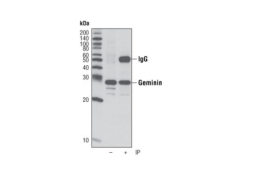 Immunoprecipitation of geminin from 293T cells using Geminin Antibody. Western blot was performed using the same antibody. Lane 1 contains 5% input.