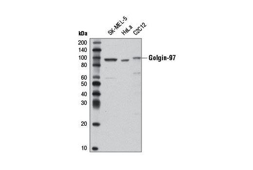 Western blot analysis of extracts from SK-MEL-5, HeLa, and C2C12 cells using Golgin-97 (D8P2K) Rabbit mAb.