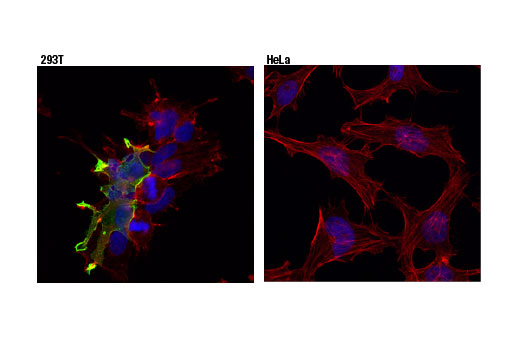 Confocal immunofluorescent analysis of 293T (left, positive), or HeLa (right, negative) cells using GPR50 (D1D6I) Rabbit mAb (green). Actin filaments were labeled with DyLight™ 554 Phalloidin #13054 (red). Blue pseudocolor = DRAQ5 ® #4084 (fluorescent DNA dye).