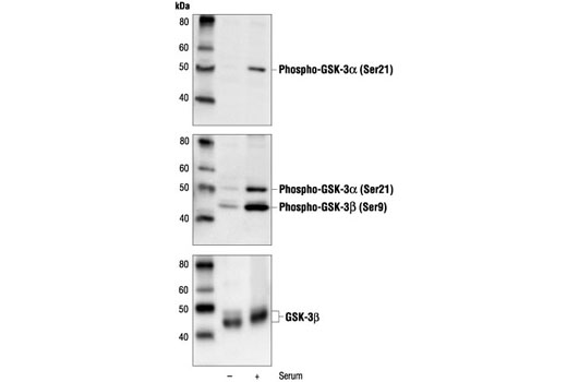 Western blot analysis of extracts from NIH/3T3 cells, control and serum treated, using Phospho-GSK-3alpha (Ser21) (46H12) Mouse mAb (top), Phospho-GSK-3alpha/beta (Ser21/9) Antibody #9331 (middle) and GSK-3beta Antibody (bottom).