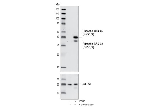 Western blot analysis of extracts from COS-7 cells, lamda phosphatase- or PDGF-treated, using Phospho-GSK-3α/β (Ser21/9) (37F11) Rabbit mAb (GSK-3alpha Preferred) (upper) or GSK-3alpha Antibody #9338 (lower).