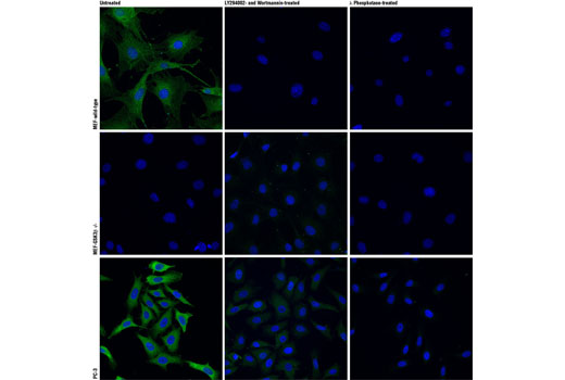 Confocal immunofluorescent analysis of wild type mouse embryonic fibroblasts (MEFs) (top row), GSK-3β (-/-) MEFs (middle row) , or PC-3 cells (bottom row), untreated (left), LY294002- and Wortmannin-treated (#9901 and #9951 respectively; center) or lambda phosphatase-treated (right), using Phospho-GSK-3β (Ser9) (D85E12) XP ® Rabbit mAb (green). Actin filaments were labeled with DY-554 phalloidin (red). Blue pseudocolor = DRAQ5 ® #4084 (fluorescent DNA dye). (MEF wild type and GSK-3β (-/-) cells were kindly provided by Dr. Jim Woodgett, University of Toronto, Canada).