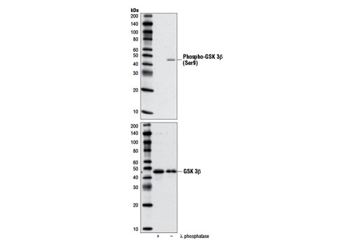 Western blot analysis of extracts from NIH/3T3 cells, λ phosphatase treated or untreated, using Phospho-GSK-3bβ (Ser9) Antibody (upper) or GSK-3β (27C10) Rabbit mAb #9315 (lower).