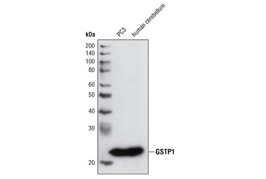 Western blot analysis of extracts from PC3 cells and human cerebellum using GSTP1 (3F2) Mouse mAb.
