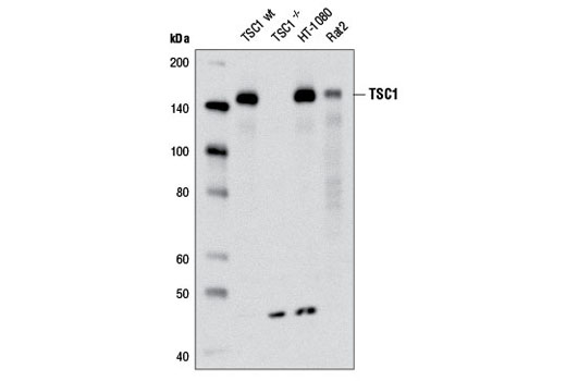 Western blot analysis of extracts from wild type and TSC1 -/- MEF cells, HT-1080, and Rat2 cells using Hamartin/TSC1 (D43E2) Rabbit mAb.