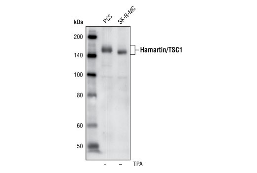 Western blot analysis of extracts from PC3 and SK-N-MC cells, using Hamartin/TSC1 (1B2) Mouse mAb.