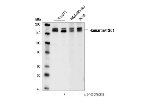 Western blot analysis of extracts from NIH/3T3, MDA-MB-468 and PC12 cells, untreated or lambda phosphatase-treated, using Hamartin/TSC1 Antibody.