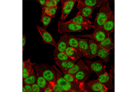 Confocal immunofluorescent analysis of MCF7 cells using HAUSP (D17C6) XP ® Rabbit mAb (green). Actin filaments have been labeled with DY-554 phalloidin (red).