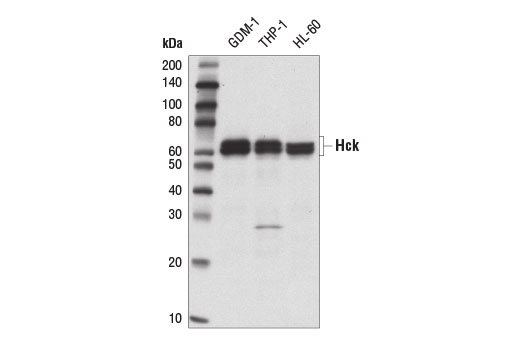 Western blot analysis of extracts from GDM-1, THP-1, and HL-60 cell lines using Hck (E1I7F) Rabbit mAb.