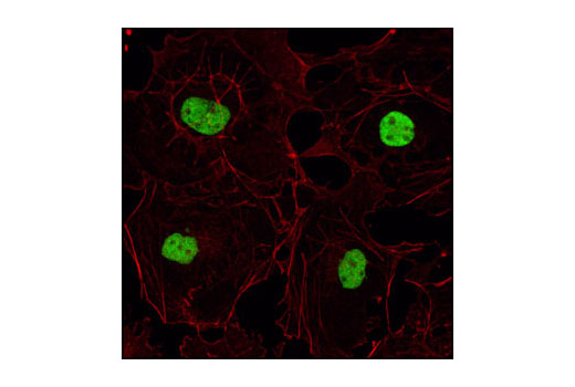 Confocal immunofluorescent analysis of COS cells using HDAC2 Antibody (green). Actin filaments have been labeled with Alexa Fluor ® 555 phalloidin (red).
