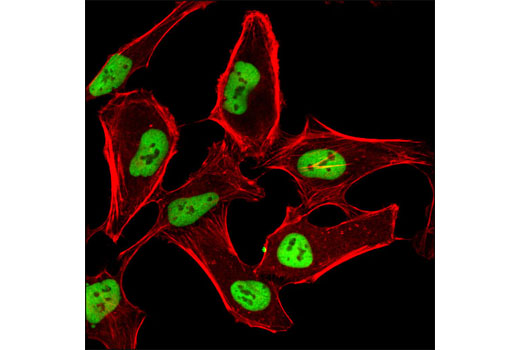 Confocal immunofluorescent analysis of HeLa cells using HDAC2 (3F3) Mouse mAb (green). Actin filaments were labeled using DY-554 Phalloidin (red).