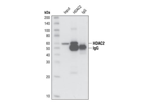 Immunoprecipitation/Western blot analysis of extracts from 293 cells. Lane 1 contains lysate input (5%), lane 2 was immunoprecipitated with HDAC2 Antibody (IP Preferred) and lane 3 was immunoprecipitated with non-specific rabbit IgG. Western blot analysis was performed using HDAC2 Antibody (IP Preferred).