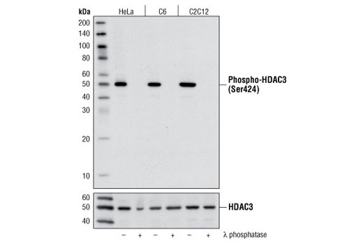 Western blot analysis of extracts from HeLa, C6 and C2C12 cells, untreated or λ-phosphatase-treated, using Phospho-HDAC3 (Ser424) Antibody (upper) or HDAC3 Antibody #2632 (lower).