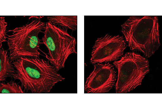 Confocal immunofluorescent analysis of HeLa cells, untreated (left) or λ-phosphatase-treated (right), using Phospho-HDAC3 (Ser424) Antibody (green). Actin filaments were labeled using DY-554 phalloidin (red).