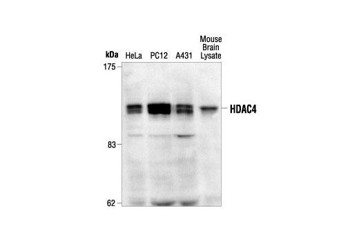 Western blot analysis of extracts from various cell types or tissue using Histone Deacetylase 4 (HDAC4) Antibody.