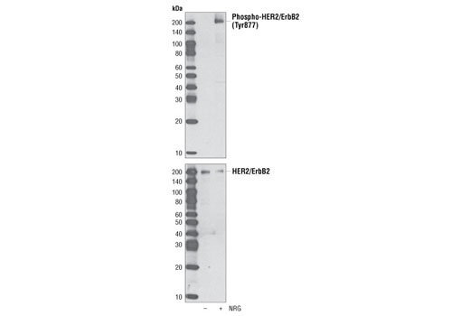 Western blot analysis of extracts from MCF-7 cells, untreated or treated with neuregulin (NRG), using Phospho-HER2/ErbB2 (Tyr877) Antibody (upper) and HER2/ErbB2 Antibody #2242 (lower).