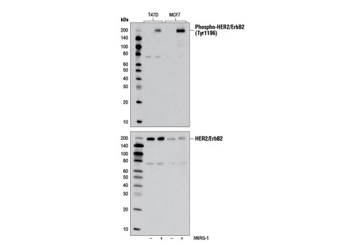 Western blot analysis of extracts from T47D and MCF7 cells, untreated or treated with human neuregulin-1 #5218 (100 ng/ml, 5 min), using Phospho-HER2/ErbB2 (Tyr1196) (D66B7) Rabbit mAb (upper) and HER2/ErbB2 (29D8) Rabbit mAb #2165 (lower).