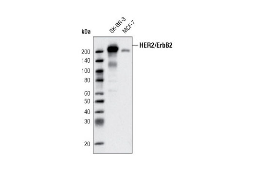 Western blot analysis of extracts from SK-BR-3 and MCF7 cells using HER2/ErbB2 (D8F12) XP ® Rabbit mAb.