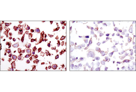 Immunohistochemical analysis of paraffin-embedded SK-BR-3 (Her2 high, left) and MCF7 cell pellets (Her2 low, right) using HER2/ErbB2 (D8F12) XP ® Rabbit mAb.