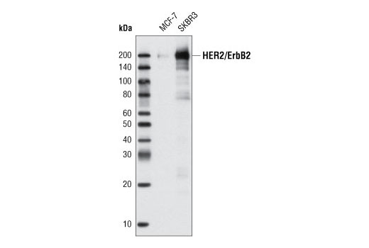 Western blot analysis of extracts from MCF-7 and SKBR3 cells using HER2/ErbB2 Antibody.