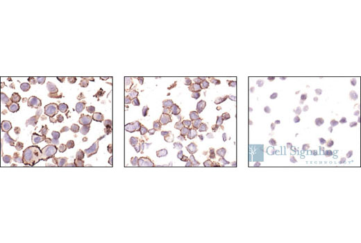 Immunohistochemical analysis of paraffin-embedded cell lines expressing various levels of Her2, SK-Br-3- high (left), MDA-MB-453 - medium (middle) and MDA-MB-468 - low (right), using HER2/ErbB2 Antibody.