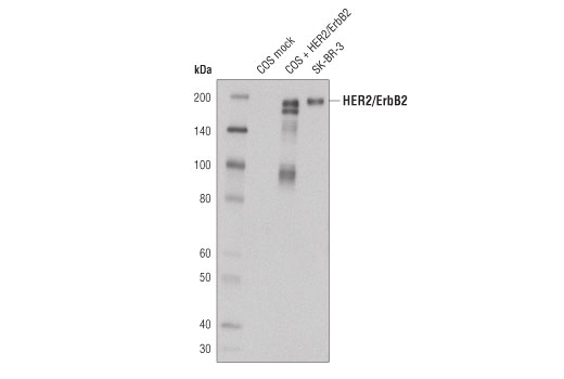 Western blot analysis of extracts from SK-BR-3 cells as well as COS cells mock transfected or transfected with Her2/ErbB2 using Her2/ErbB2 (44E7) Mouse mAb #2248.