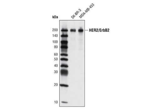 Western blot analysis of cell extracts from SK-BR-3 and MDA-MB-453 cells using HER2/ErbB2 (M45) Antibody.