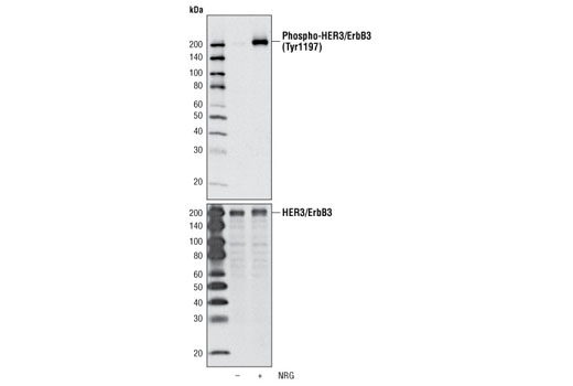 Western blot analysis of extracts from T47D cells, untreated or treated with neuregulin (NRG), using Phospho-HER3/ErbB3 (Tyr1197) (C56E4) Rabbit mAb (upper) and HER3/ErbB3 (1B2) Rabbit mAb #4754 (lower).