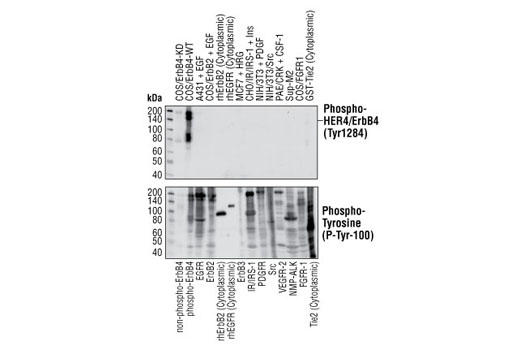 Western blot analysis of extracts from various cell lines expressing different activated protein tyrosine kinases, using Phospho-HER4/ErbB4 (Tyr1284) (21A9) Rabbit mAb or Phospho-Tyrosine Mouse mAb (P-Tyr-100) #9411 (lower).