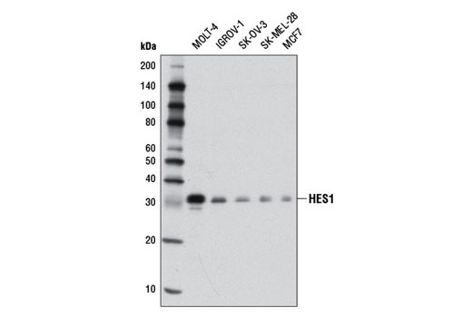 Western blot analysis of extracts from various cell lines using HES1 (D6P2U) Rabbit mAb.