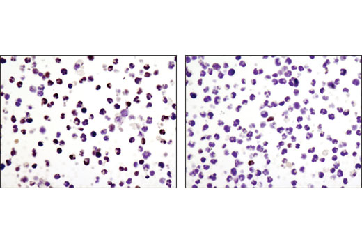 Immunohistochemical analysis of paraffin-embedded CUTLL1 cell pellets, control (left) or Compound E-treated (right), using HES1 (D6P2U) Rabbit mAb.