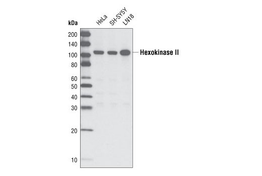 Western blot analysis of extracts from HeLa, SH-SY5Y and LN18 cells using Hexokinase II Antibody.