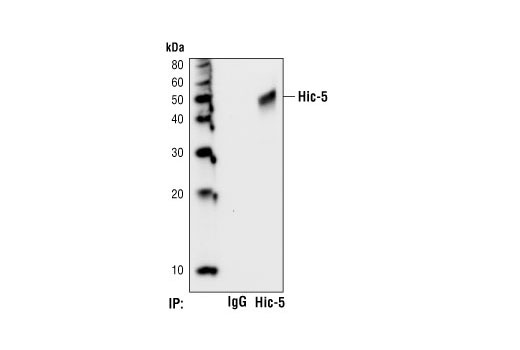 Immunoprecipitation of Hic-5 from 293 cell lysates using Hic-5 Antibody or rabbit IgG control. Western blot was performed using a Hic-5 Mouse mAb.