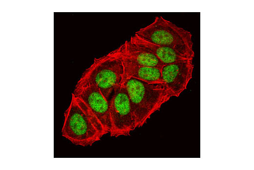 Confocal immunofluorescent analysis of MCF7 cells using HIF-1β/ARNT (C15A11) Rabbit mAb (green). Actin filaments have been labeled with DY-554 phalloidin (red).