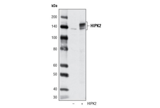 Western blot analysis of extracts from 293T cells, mock transfected (-) or transfected with a mouse HIPK2 construct (+), using HIPK2 Antibody.