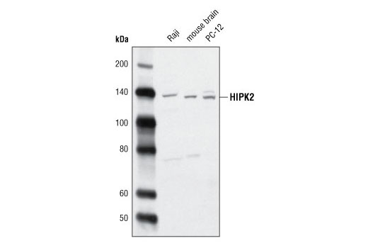 Western blot analysis of extracts from Raji cells, mouse brain, and PC-12 cells using HIPK2 Antibody.