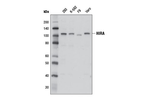 Western blot analysis of extracts from various cell lines using HIRA (D6O8L) Rabbit mAb.