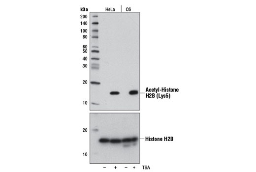 Western blot analysis of extracts from HeLa and C6 cells, untreated (-) or treated with Trichostatin A (TSA) #9950 (1 μM, 18hr; +), using Acetyl-Histone H2B (Lys5) (D5H1S) XP ® Rabbit mAb (upper) or Histone H2B (D2H6) Rabbit mAb #12364 (lower).