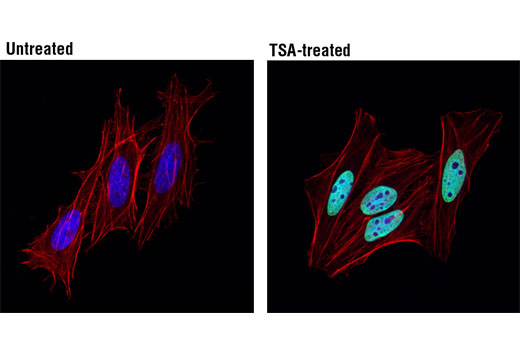 Confocal immunofluorescent analysis of HeLa cells, untreated (right) or treated with Trichostatin A (TSA) #9950 (left), using Acetyl-Histone H2B (Lys5) (D5H1S) XP ® Rabbit mAb (green). Actin filaments were labeled with DY-554 phalloidin (red). Blue pseudocolor = DRAQ5 ® #4084 (fluorescent DNA dye).