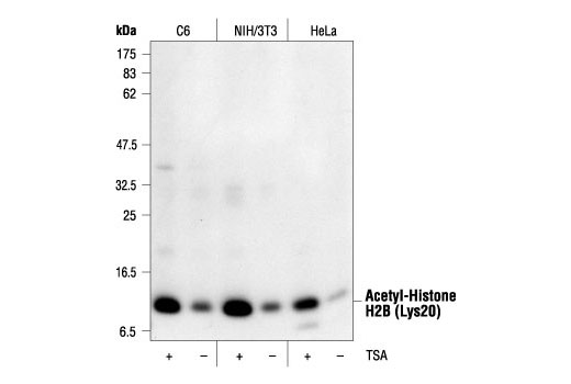 Western blot analysis of extracts from various cell lines, untreated or TSA-treated (400 nM for 12 hours), using Acetyl-Histone H2B (Lys20) Antibody.