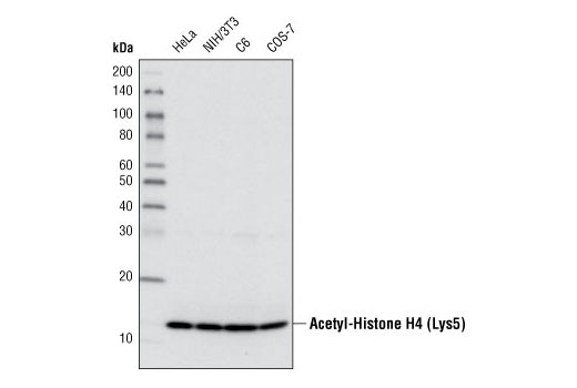 Western blot analysis of extracts from various cell lines using Acetyl-Histone H4 (Lys5) Antibody.
