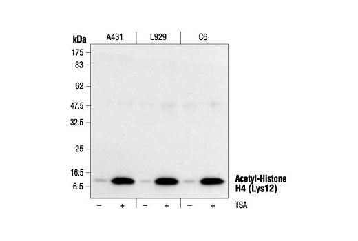 Western blot analysis of extracts from various cell lines untreated or TSA-treated (400 nM TSA for 12 hours) using Acetyl-Histone H4 (Lys12) Antibody.